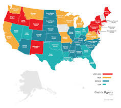 Average Cost Of Gastric Bypass Surgery