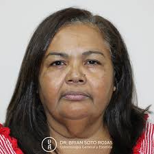 Dr. Brian Soto Rojas (@drbriansotorojas) · Instagram 照片和视频