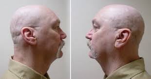 New Evidence Delays Decision