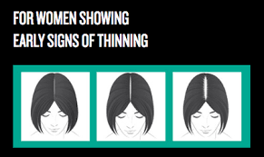 Below are some attributes that make a salon near me great. Hair Loss Thinning Hair