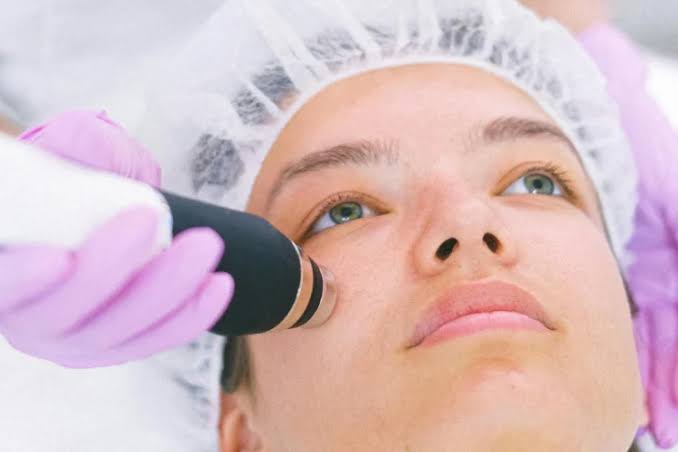 SmoothLase Facial Rejuvenation | The Wagner Centre