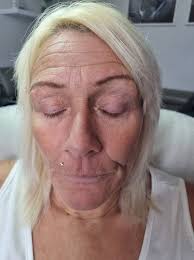 Hey, is anyone experiencing over processing from lash lifts