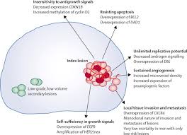 Although it is the most commonly diagnosed cancer in american women, breast cancer can impact people of all genders. Do Low Grade And Low Volume Prostate Cancers Bear The Hallmarks Of Malignancy The Lancet Oncology
