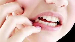 Obat sakit gigi yang manjur dan aman obat sakit gigi yang manjur buat anak obat sakit gigi yang ampuh buat anak anak obat s gigi huruf tulis tangan penyakit. 5 Cara Mengobati Gusi Bengkak Dengan Obat Dari Apotik Lampung Co