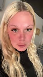 Ashley Sinclair Emotional Support Chicken