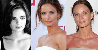 Learn about the ten most frequently performed cosmetic surgeries in the united states. Gabrielle Anwar Plastic Surgery Before And After Pictures 2021