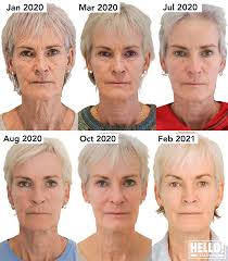 Judy took a few mandarin oranges and she clustered the fruits in such a manner that it spelled the word hello. Judy Murray Shows Off Very Youthful Makeover And Reveals Her Cosmetic Treatment Hello