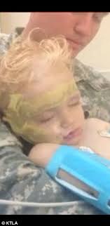 Toddler left with facial injuries after being mauled by Labrador at  California park