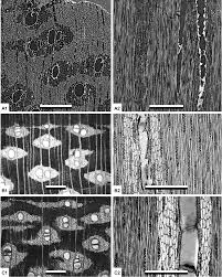 Image result for Xylopia katangensis