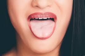 Por Que La Lengua Se Pone Blanca Blog Isalud