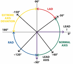 the basics of ecg interpretation part 2 rate rhythm and