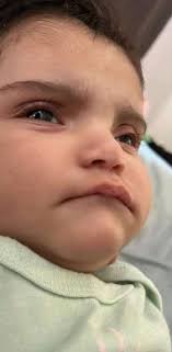 Do his eyes look fine in the pictures?