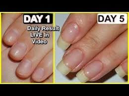 Naturally Grow Your Nails Faster Within A Week Easy Effective Home Remedy Youtube How To Grow Nails Nail Growth Tips Make Nails Grow