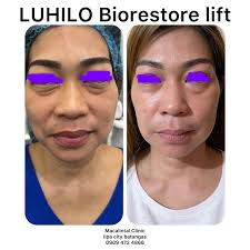 Nutrient para sa mga magulang natin . . . . SHOPEE:  https://ph.shp.ee/SpVudkA LAZADA: https://s.lazada.com.ph/s.Jj5cs TIKTOK:  https://vt.tiktok.com/ZSr65LvXa/