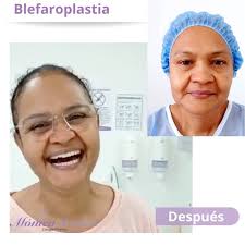 No necesito mas para que mi día tenga sentido. Cuando mis pacientes me  dicen que pueden ser más libres en su día a día, sentirse más felices, más  hermosas... Yo se que hice una gran labor. , Qué ...