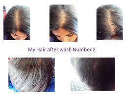 Every hair loss product has hype from day one, as long as it shows a glimmer of hope. Nioxin Nioxin Hair System Kit 2 Noticeably Thinning Hair Review Beauty Bulletin Treatments Masks