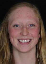The Gazette Preps Girls' Swimming and Diving All-Area teams