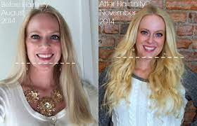 We did not find results for: Do Hair Vitamins Really Work