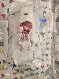 Hi all! This is Remy- my 22w2d baby. He will be 7 days old tomorrow. We  have already been through so much… and we can't see the light at the end of
