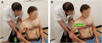 Image result for Shoulder Relocation Maneuvers