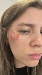 Kind stranger helps injured child with new bike