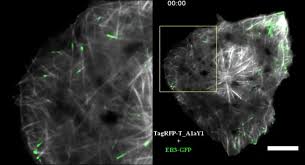 We did not find results for: Genetically Encoded Live Cell Sensor For Tyrosinated Microtubules Journal Of Cell Biology Rockefeller University Press