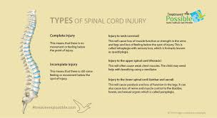 Image result for Spinal Shock