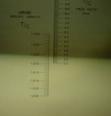 Urine Specific Gravity Wikipedia