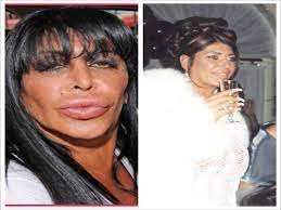 Some may even do harm. Big Ang Before The Surgery Nickelimages