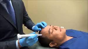 Shop for a microneedling device online. Shedding Microneedling Microneedling Update Shedding Light On The Technology Benefits Of Microneedling How To Prepare For Microneedling What To Expect From Microneedling Love Would Be