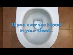 Image result for blood in stool human poop