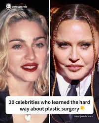 20 celebrities who learned the hard way about plastic surgery (link in the  comments)