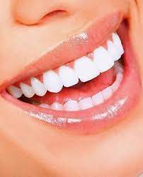 Pin On Natural Teeth Whitening
