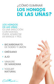 Hongos En Las Uñas De Las Manos Como Eliminarlos 5 Remedios Caseros Para Eliminar Hongos En Las Unas Dra Coco Remedios Caseros Para Hongos En Unas Tratamiento Para Hongos En Las Unas Remedio Para Hongos