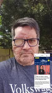 Adam Pearson Hermano