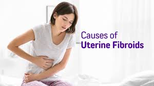 Uterine Fibroids ...