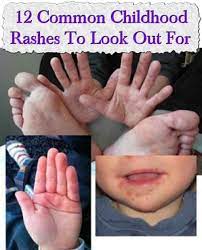 Pin On Remedies