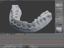 How To 3d Print Plastic Braces For 60 Business Insider Plastic Braces Dental Braces 3d Printing