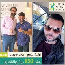 زراعة شعر بالتقسيط نتيجة فقط بعد الدكتور احمد سمرين لزراعة الشعر فيسبوك