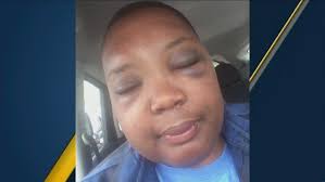 Gay couple attacked in SoCal sparking hate crime investigation