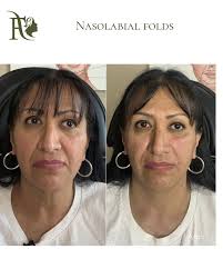 Flawless Medical Aesthetics