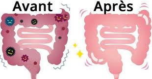 Il Est Imperatif De Proceder Au Nettoyage Du Colon Regulierement Afin D Eliminer Les Dechets Et Les Toxines Qu Nettoyer Colon Comment Degonfler Nettoyage Colon