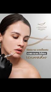 O preenchimento labial vai além de simplesmente adicionar volume aos  lábios. Além de recuperar o volume que perdemos com o tempo, esse  procedimento também se destaca ao oferecer benefícios como ...