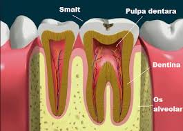 Imagini pentru scoaterea nervului dentar