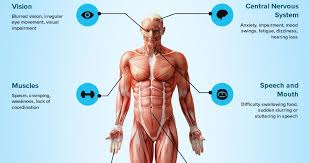 Multiple sclerosis (ms) symptoms are varied and range from pain, to vision problems, to mobility issues. Signs And Symptoms Of Multiple Sclerosis Infographic