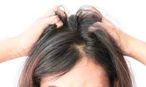 Sac Nezlesi Nedir Protez Sac Hairvision