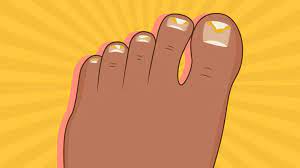 5 Things You Didn T Know About Toenail Fungal Infections Everyday Health