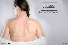Consult a doctor for medical advice. Syphilis How Can It Be Treated By Burlington Clinic India Best Sexologist Lybrate