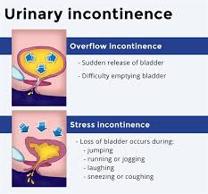 What To Know Urinary Incontinence Blog Baycare Clinic