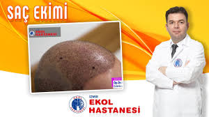 Sac Ekimi Izmir Ekol Hastanesi